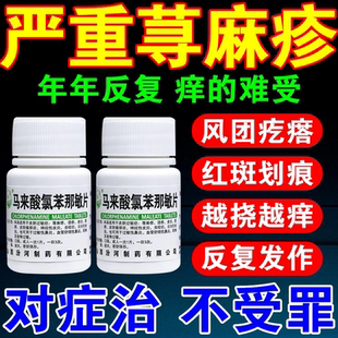 扑尔敏过敏药寻荨麻疹过敏止痒断树根专用药荨麻疹内服药