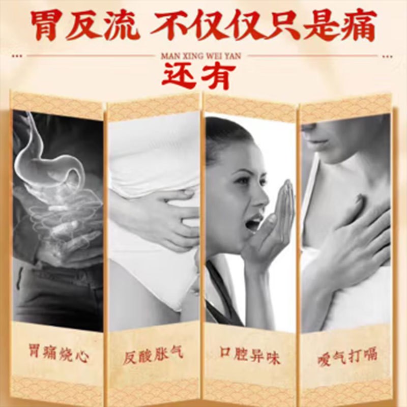 反流性食管炎反酸烧心恶心干呕萎缩性胃炎胃溃疡胆汁反流调理贴yy