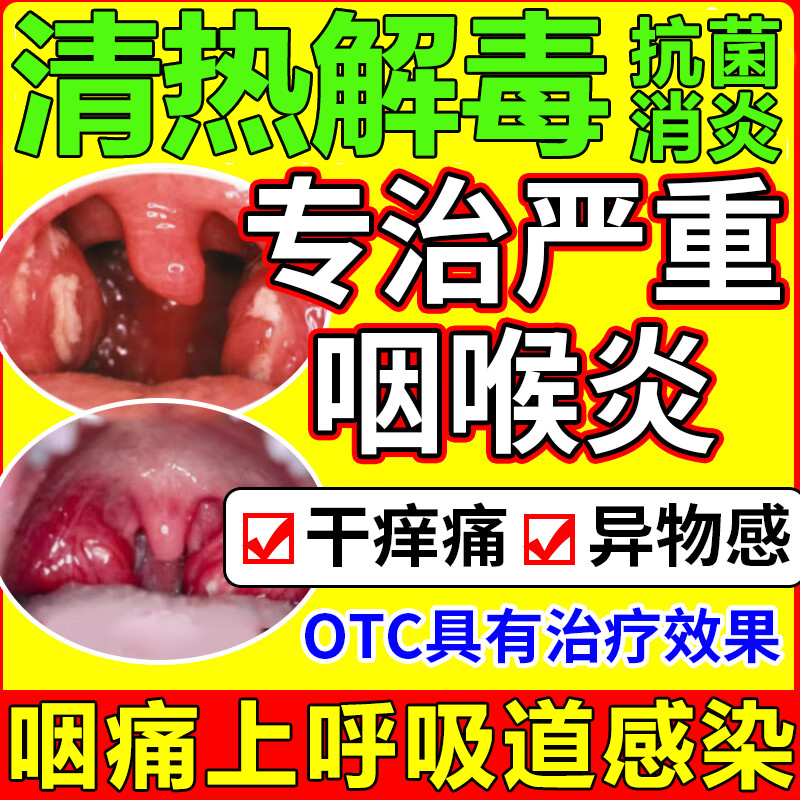 天士力穿心莲内酯滴丸清热解毒抗菌消炎呼吸道感染咽喉炎咽干咽痛