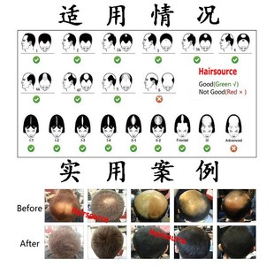 买2送1 FPLUMP增发纤维假发男假发女密发粉补发美头发浓发稀顶多