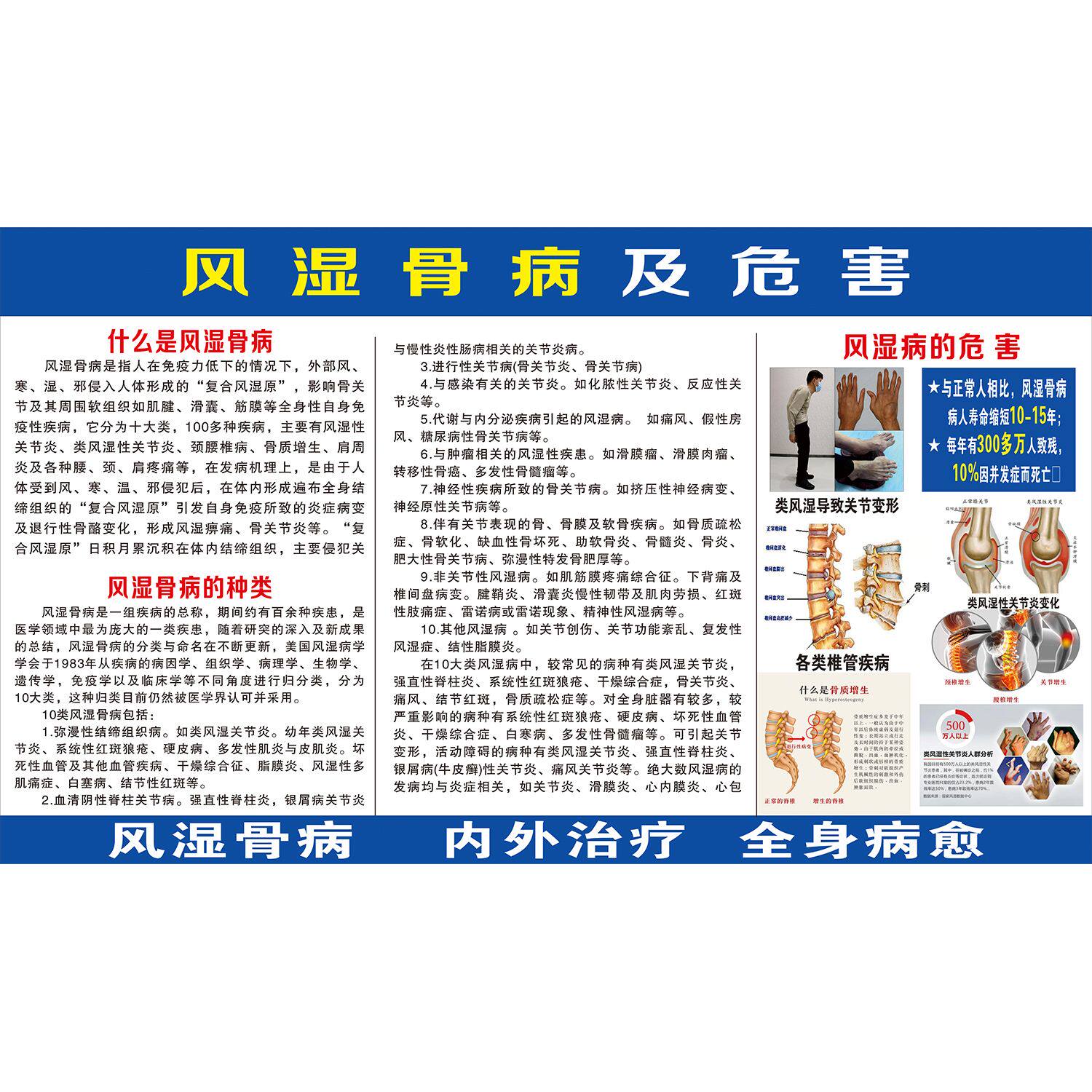 海报常见疾病海报展板挂图风湿骨病及危害海报印制,家居饰品,软装墙贴,淘宝优惠券,粉丝福利购,淘宝优惠卷