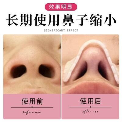 鼻翼缩小神器防抠鼻子鼻梁保护贴固定鼻夹鼻部塑形隆鼻术后保护贴