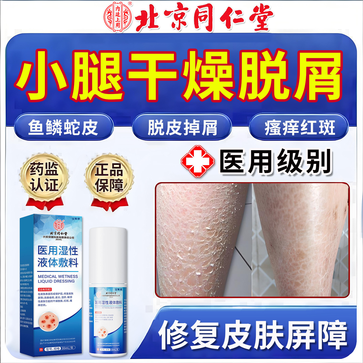 干性湿疹膏鱼鳞皮蛇皮肤专用小腿皮肤干燥