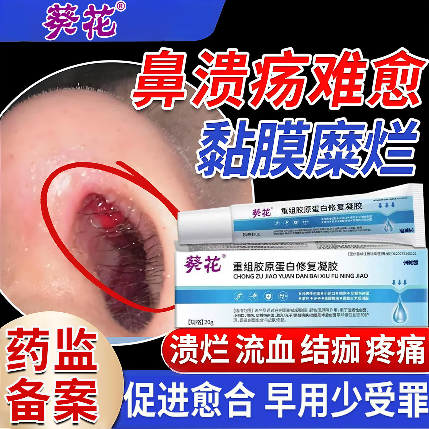 鼻中隔鼻腔溃疡上火鼻子生疮结痂鼻黏膜糜烂干燥性鼻炎修复凝胶