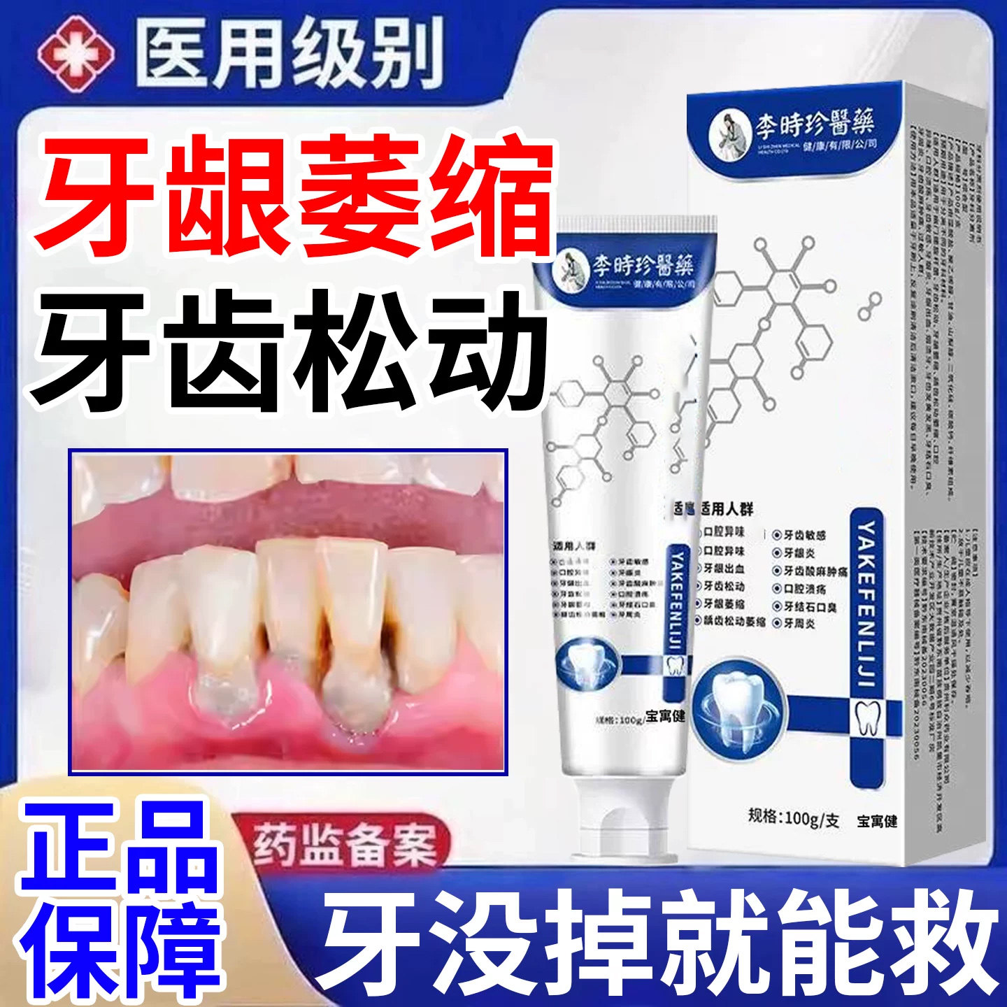 李时珍牙科分离剂牙龈萎缩修复再生牙专用牙周炎官方旗舰店正品膏图片