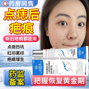 激光点痣后修复膏疤痕红印去黑印医用色素沉淀消印液凹陷增生专用