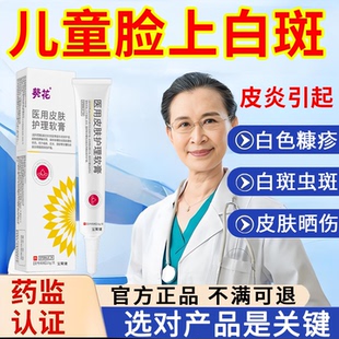 白色糠疹药膏儿童脸上长白斑紫外线过敏太阳晒伤皮肤发痒宝宝医用