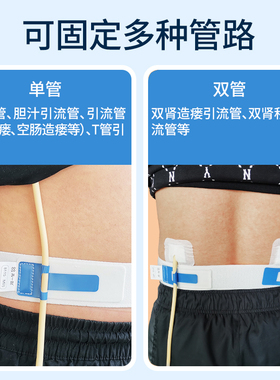 胃造瘘导管固定腰带 双肾造瘘双管固定腰带腰部腹腔胆汁T管引流管