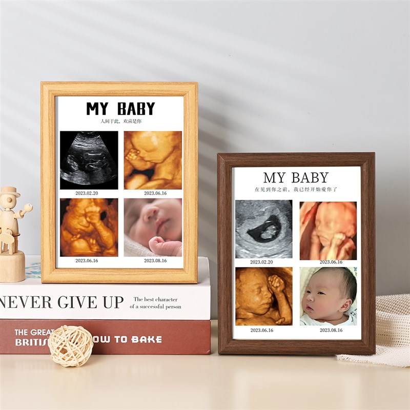 宝宝B超相框四维照片打印孕期NT记录婴儿胎儿彩超摆台定制纪念照