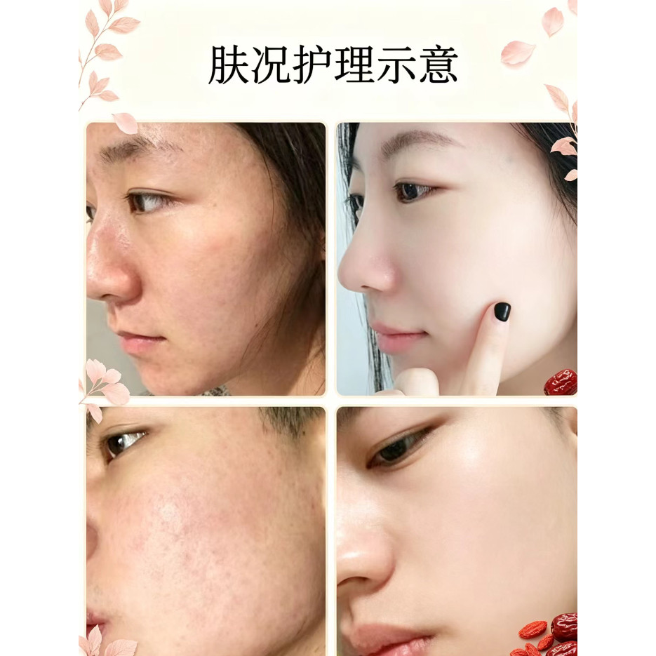 祛痘原液男女去痘痘祛痘疤痘坑凹洞修护精华去痘产品