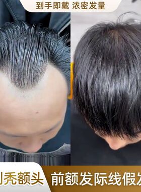 发际线贴男m型假刘海假发男生男款假发贴男士假发片无痕隐形轻薄