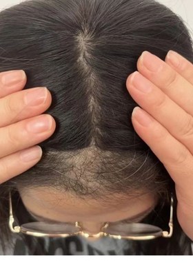 顺心假发递针刘海款娣针刘海真发补发假发补头顶遮白发无痕假发片