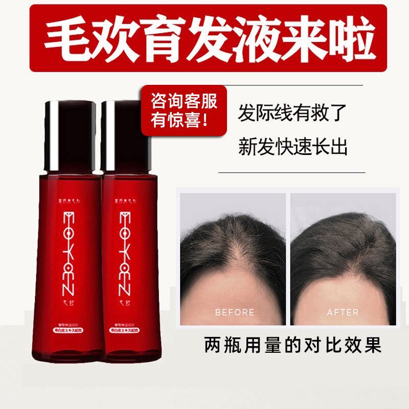 日本进口毛欢育发液 育毛剂育发防脱浓密增发神器 吴昕张柏芝推荐