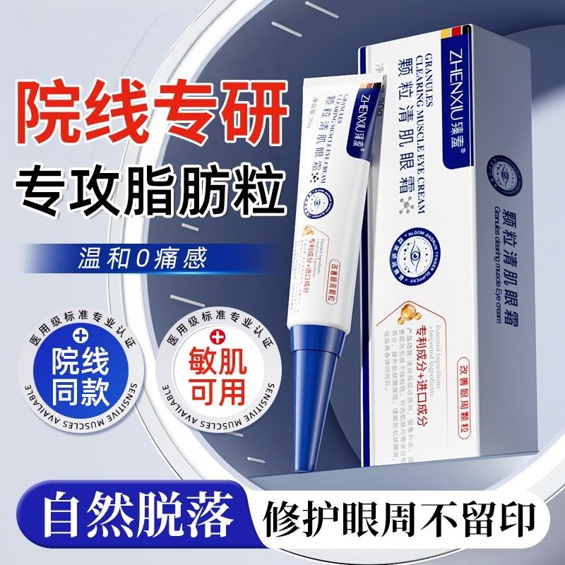 脂肪粒去除神器眼霜膏去油脂粒汗管眼部眼角瘤闭口粉刺专用