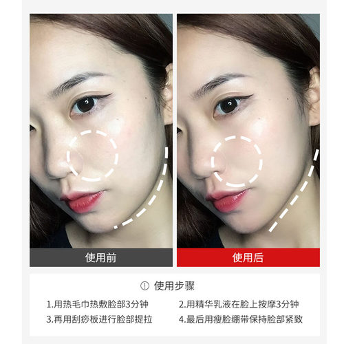 脸部美容棒拨筋棒面部眼部专用板经刮痧点穴按摩全身通用拔筋棒女