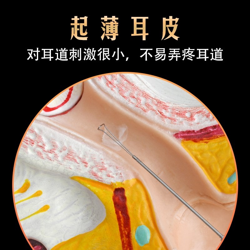 天艺技师采耳工具死皮耳铲子可视专用镂空挖耳勺耳扒U型薄皮耳起