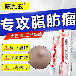 陈九玄医用聚乙二醇护创敷料皮下脂肪包重度鼓包脂肪包疙皮下囊肿