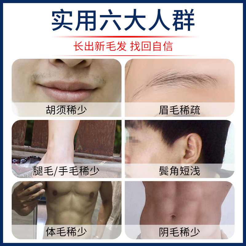 落健胡须生长液浓密男毛发长胡子浓眉毛发际线络腮胡增长增毛液