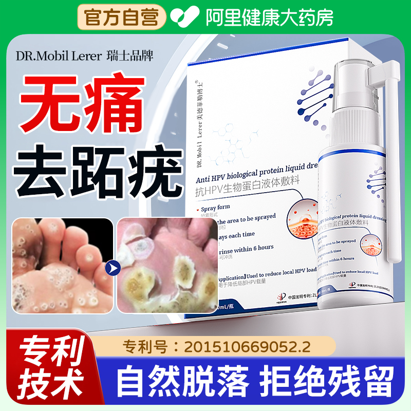 【入选天猫热销榜】去脚上跖疣