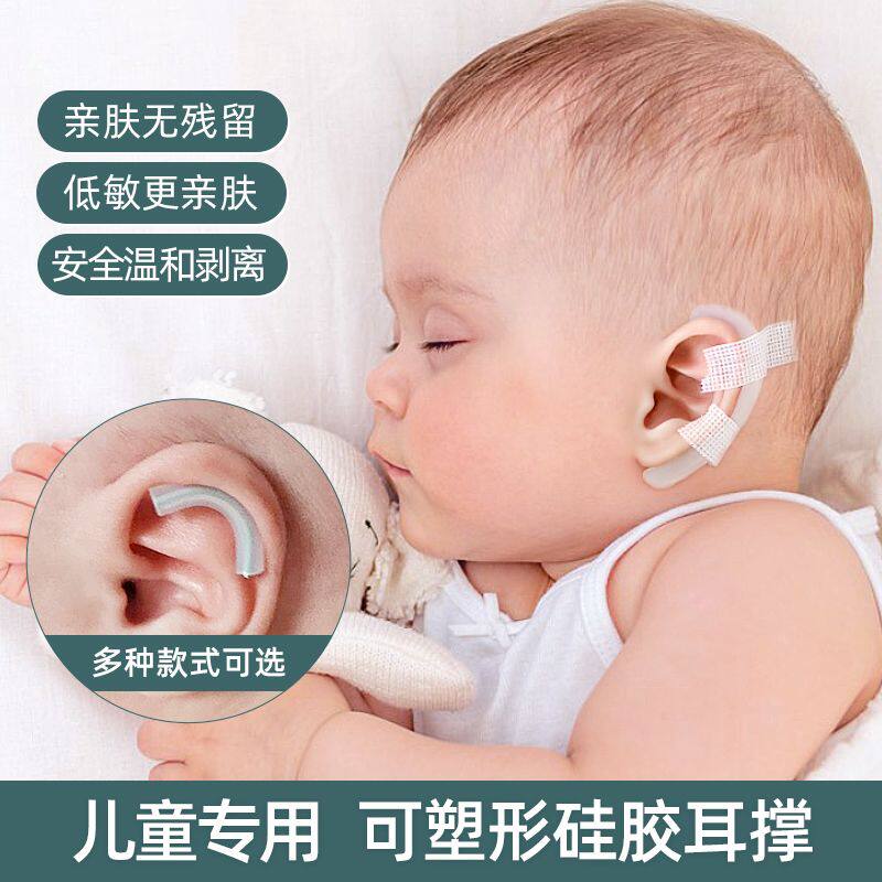婴儿耳朵矫正器新生的廓