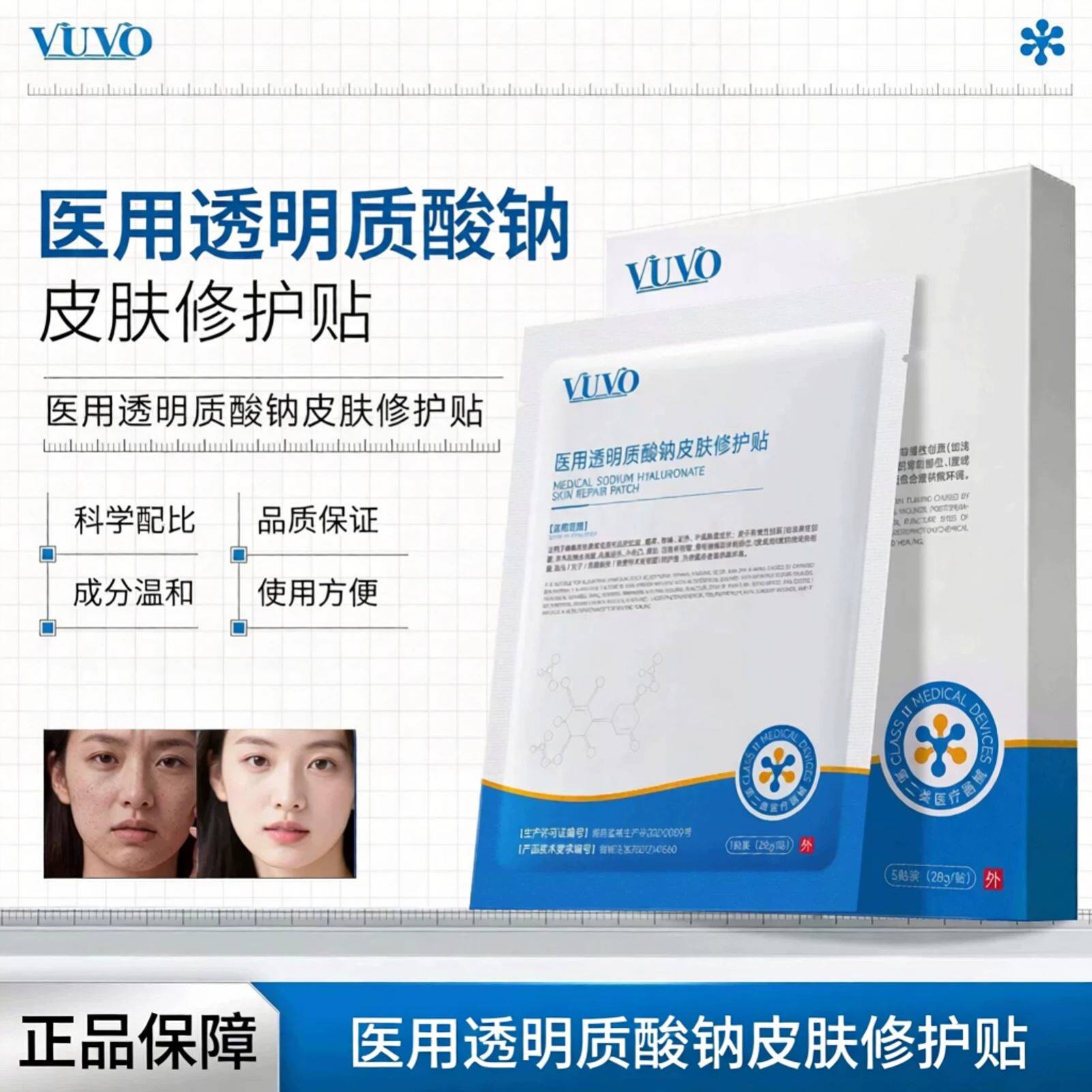 vuvo修护贴医用透明质酸钠修护贴缓解皮肤刺痛发热干燥脱屑