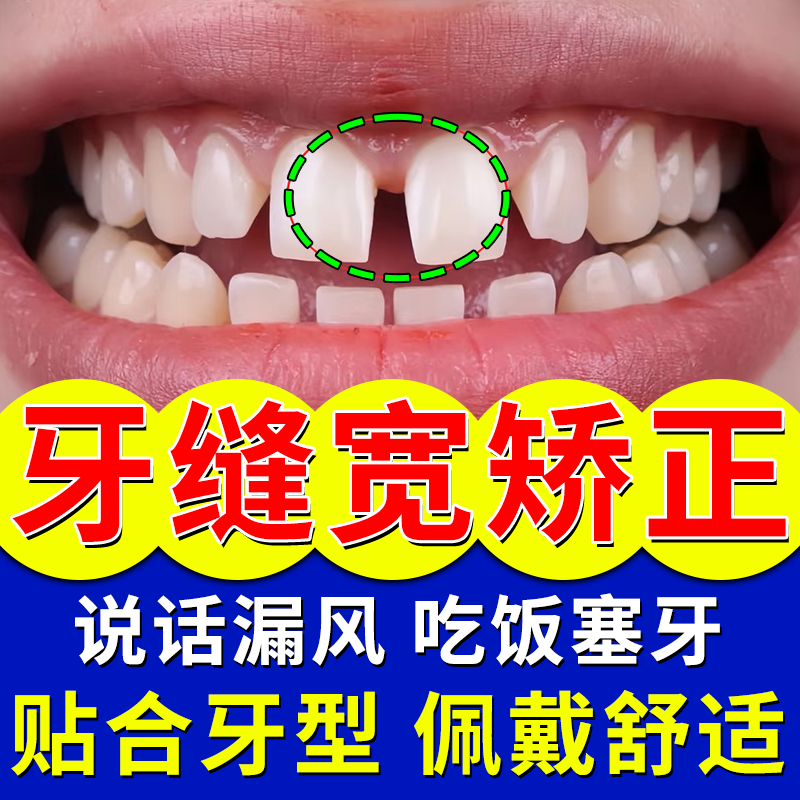 门牙缝宽大修复神器贴片门牙缝隙缩小收紧神器龅牙嘴凸牙齿矫正器