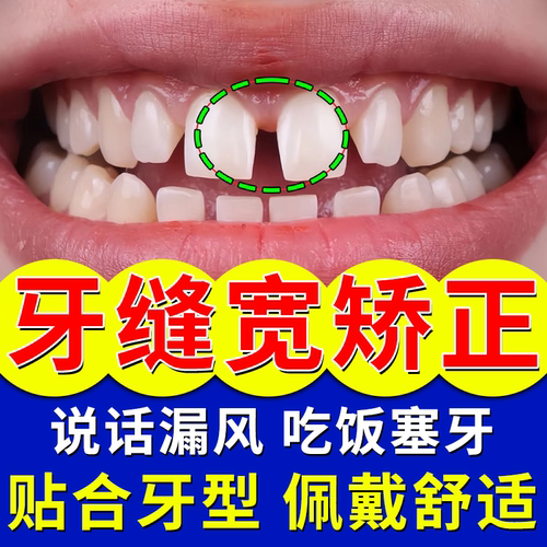 门牙缝宽大修复神器贴片门牙缝隙缩小收紧神器龅牙嘴凸牙齿矫正器