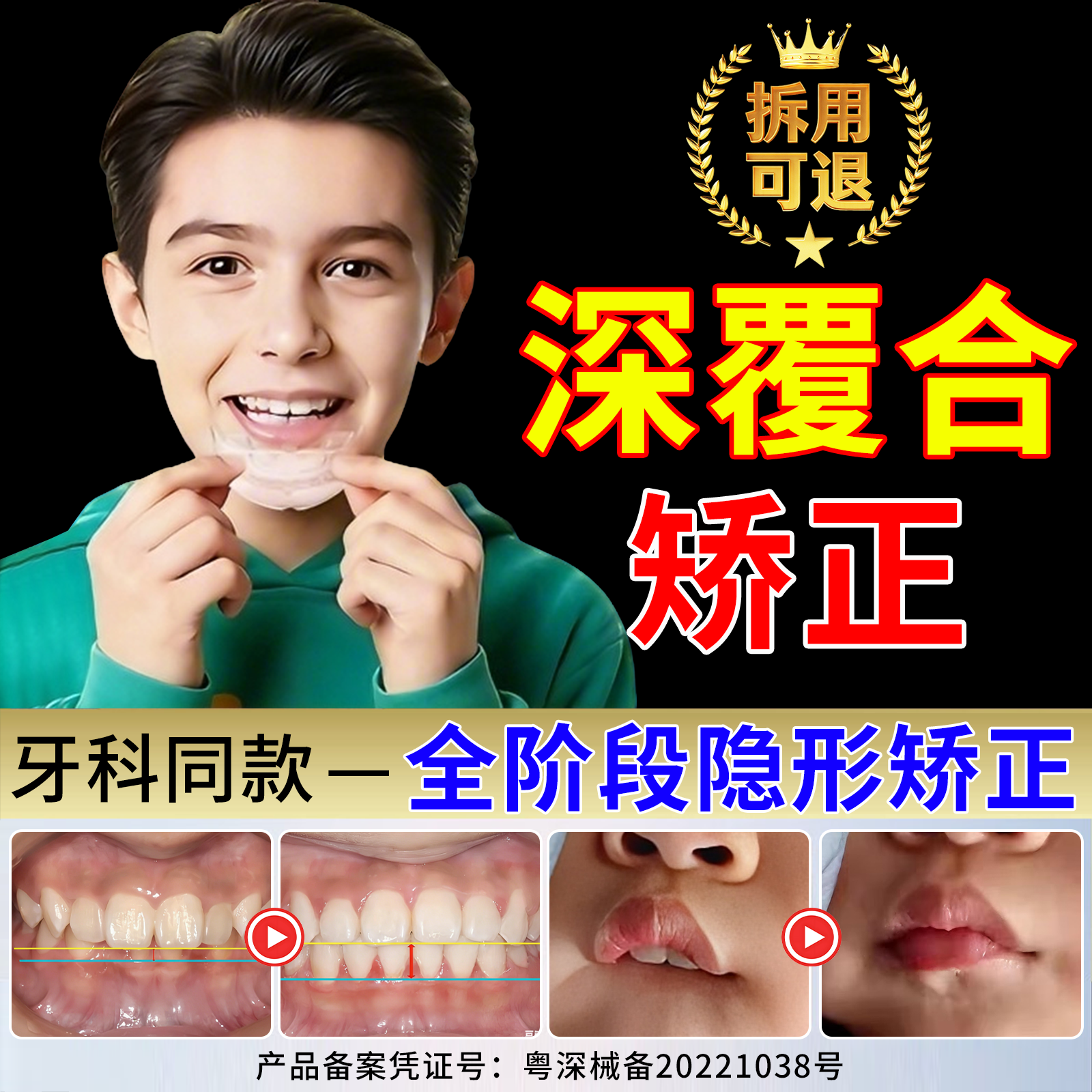 深覆合矫正器成人儿童牙齿隐形正畸神器睡觉咬合板地包天龅牙牙套