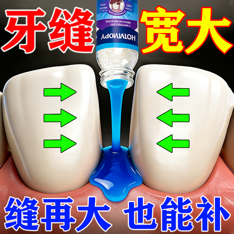 门牙缝宽大修复神器补牙材料永久医用补牙齿烂洞填充膏修复液贴片