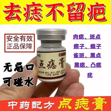 点痣膏无痕正品旗舰店点痣药膏点痣药水不留疤祛痣美容院专用去痣