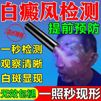 白癜风检测灯伍德灯检测家用面部皮肤检测仪专业鉴定紫外线手电筒