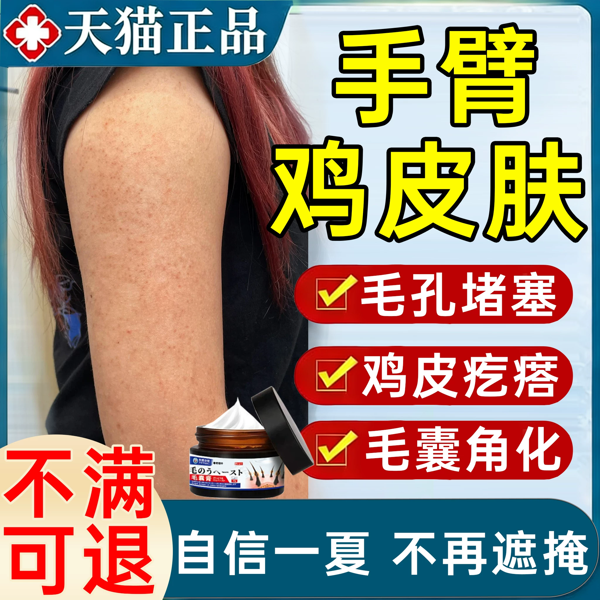 手臂鸡皮肤疙瘩毛囊角化药膏去除全身手臂腿上长疙瘩毛炎囊除螨PP
