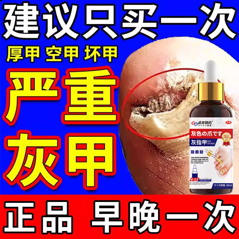 日本灰指甲抑菌液修复净趾剂正品