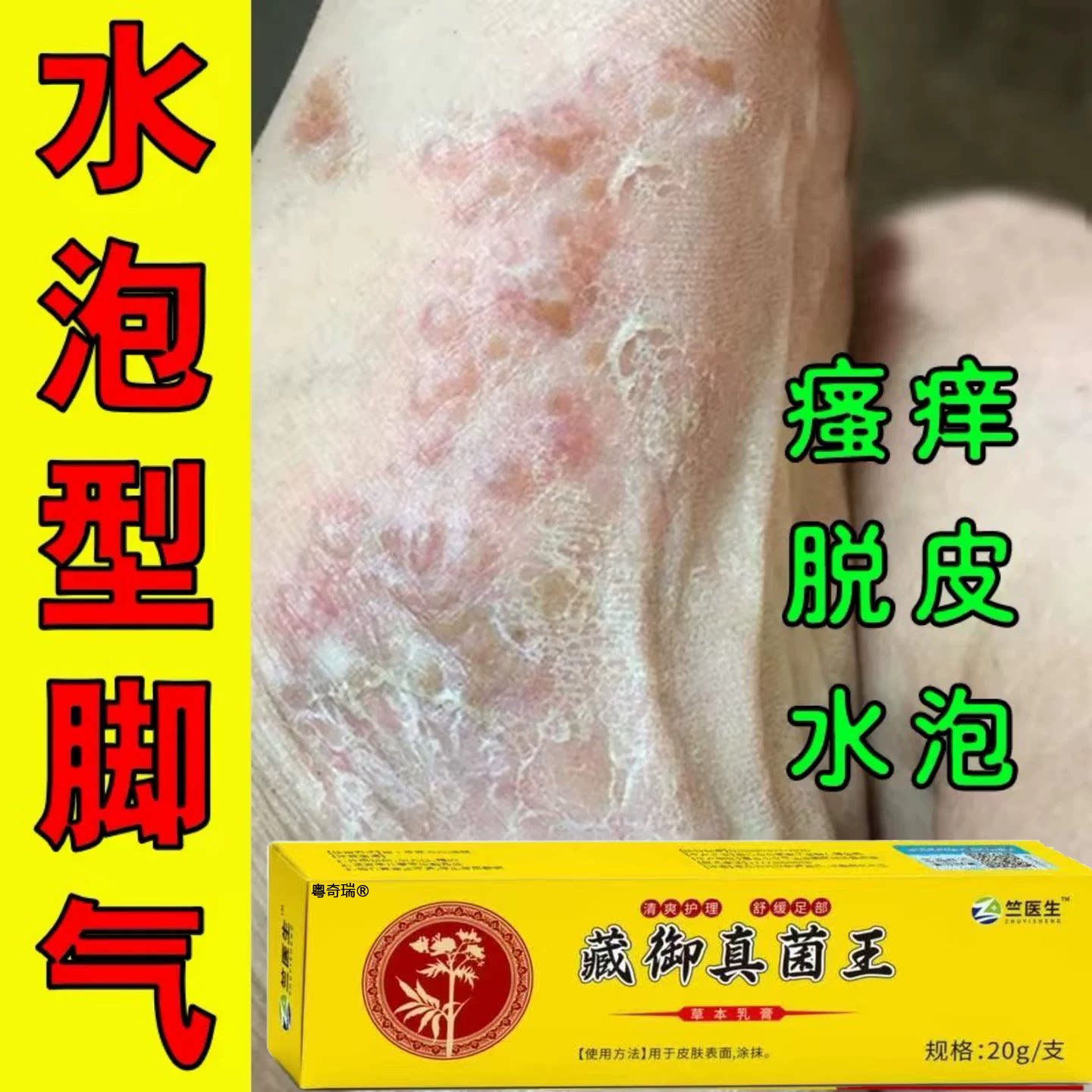 【十年脚臭气】一支搞定