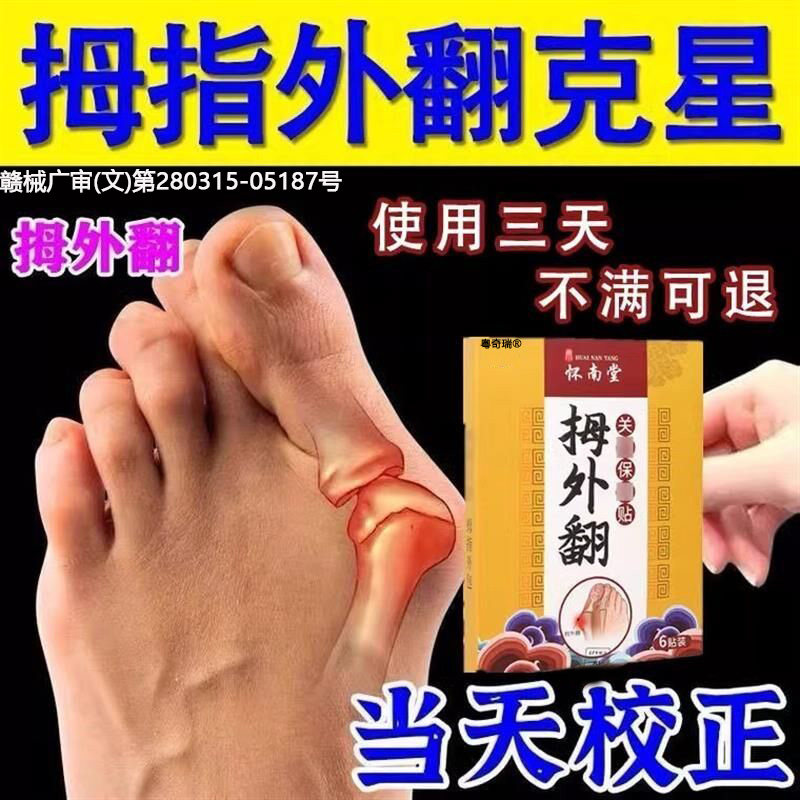 【脚拇指外翻】掰正舒缓贴肿脚趾