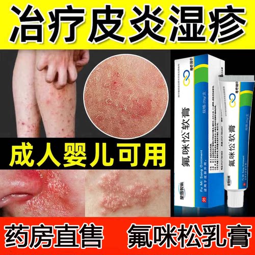 氟米咪松乳膏皮肤炎瘙痒