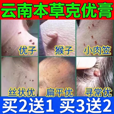 云南本草克优膏正品去除萃取