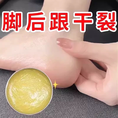 秋冬手脚开裂干燥滋润手足皴裂膏