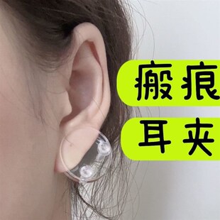 耳朵瘢痕耳夹可调压力式耳垂防止增生夹子透明压克力耳朵压力夹