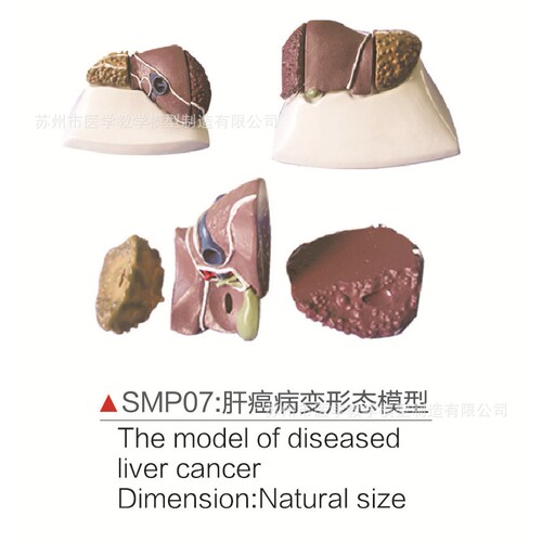 SMP07gan ai病变形态模型