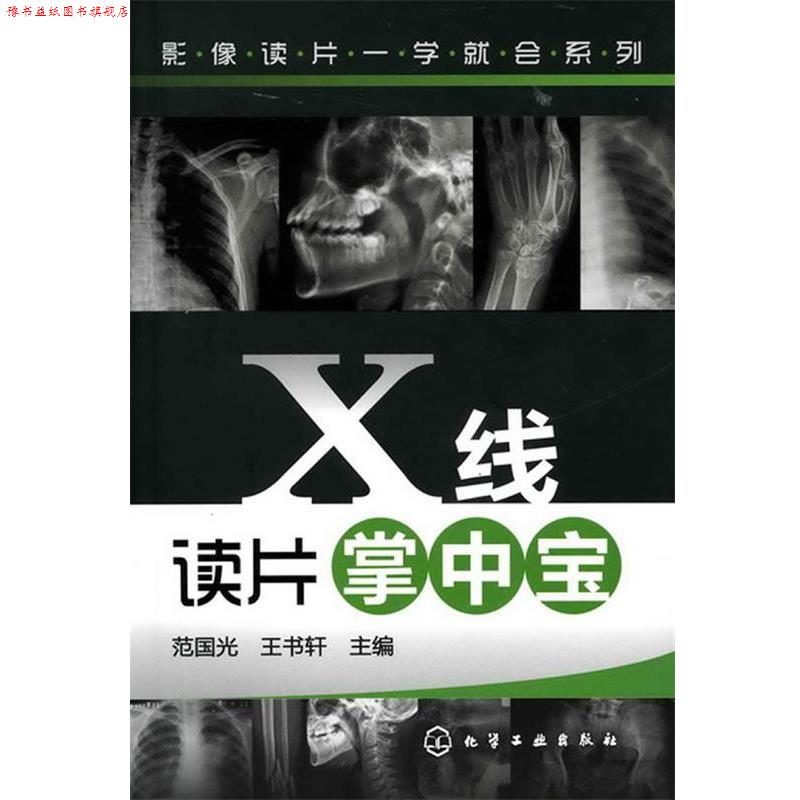 【正版书】 影像读片一学就会系列--X线读片掌中宝 范国光,王书轩 主编 化学工业出版社