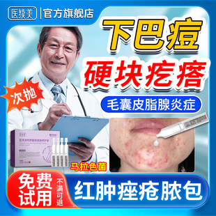 下巴反复长痘内分泌失调硬块痘痘搭膏药玫瑰痤疮屏障脓包硬疙瘩YF