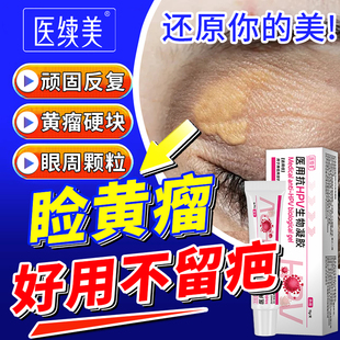 睑黄疣去除神器眼睑黄瘤专用药监备案去眼皮黄斑瘤膏YG