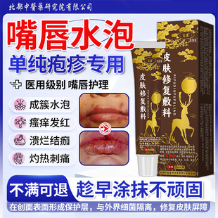 嘴唇单纯疱疹膏嘴巴上火起水泡烂嘴角药监备案口唇口角炎病毒YG