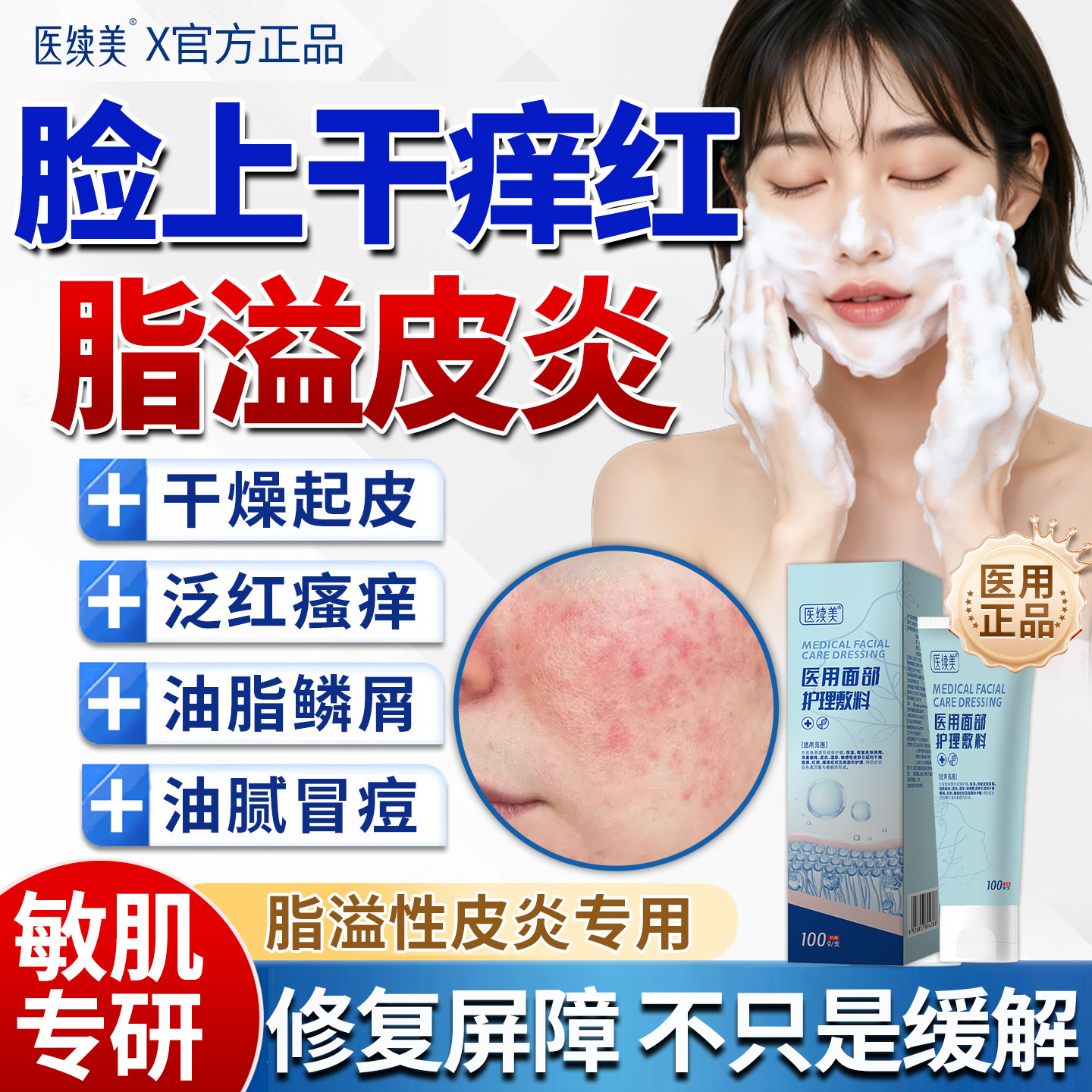 脂溢性皮炎洗面奶面部油脂性马拉色菌皮肤屏障受损鼻翼两侧泛红QN