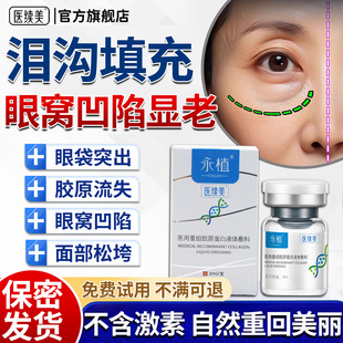 泪沟填充神器眼窝凹陷修复医用重组三型人源化胶原蛋白针护凝胶YF