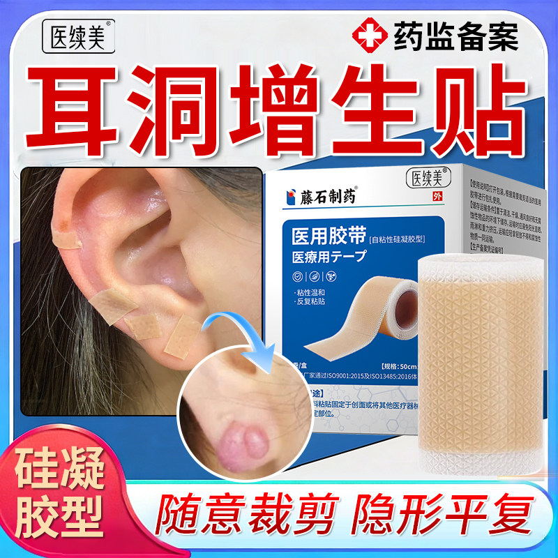 耳洞增生疤痕凸起疙瘩贴医用硅酮凝胶隐形压力遮挡去除防水肤色KD图片