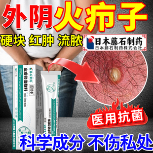 外阴火疖子瘙痒有小疙瘩毛囊炎脓拔毒膏皮脂腺囊肿专用药房同售JQ