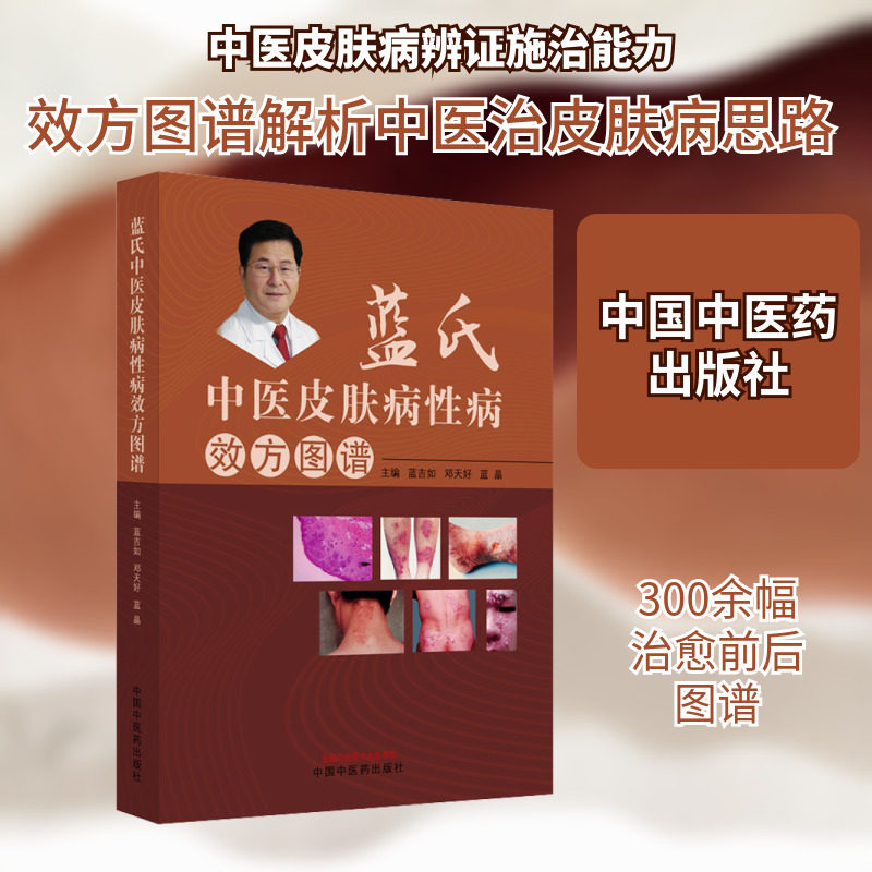 蓝氏中医治疗皮肤病性病效方图谱 中国中医药出版社 蓝吉如,邓天好,蓝晶 编 中医