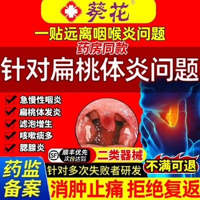 扁桃体炎贴咽喉炎慢性咽炎贴咳嗽